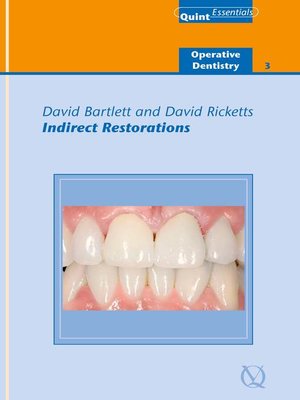 cover image of Indirect Restorations